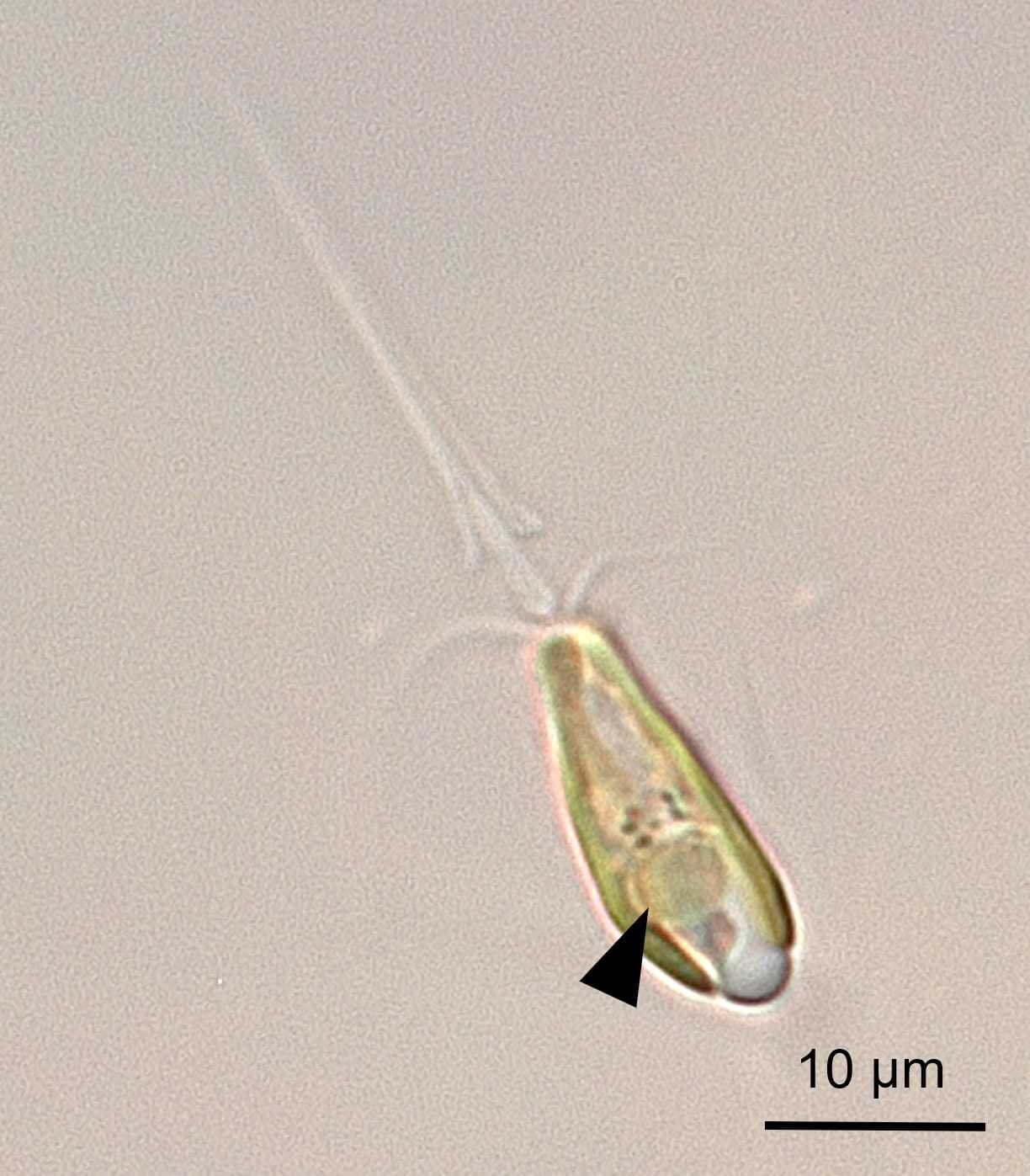 科學家發現新的胞器-固氮體(箭頭處)圖為光學顯微鏡下的B. bigelowii (照片來源：加州大學聖塔克魯茲分校Tyler_Coale)